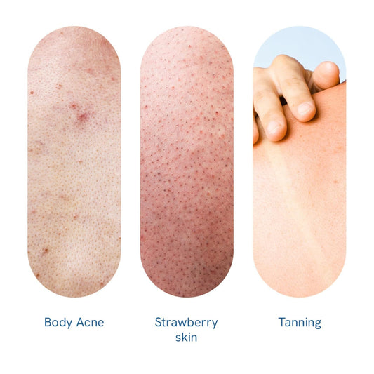 BeBodywise 10% AHA Lactic Acid Body Scrub - 300 gm