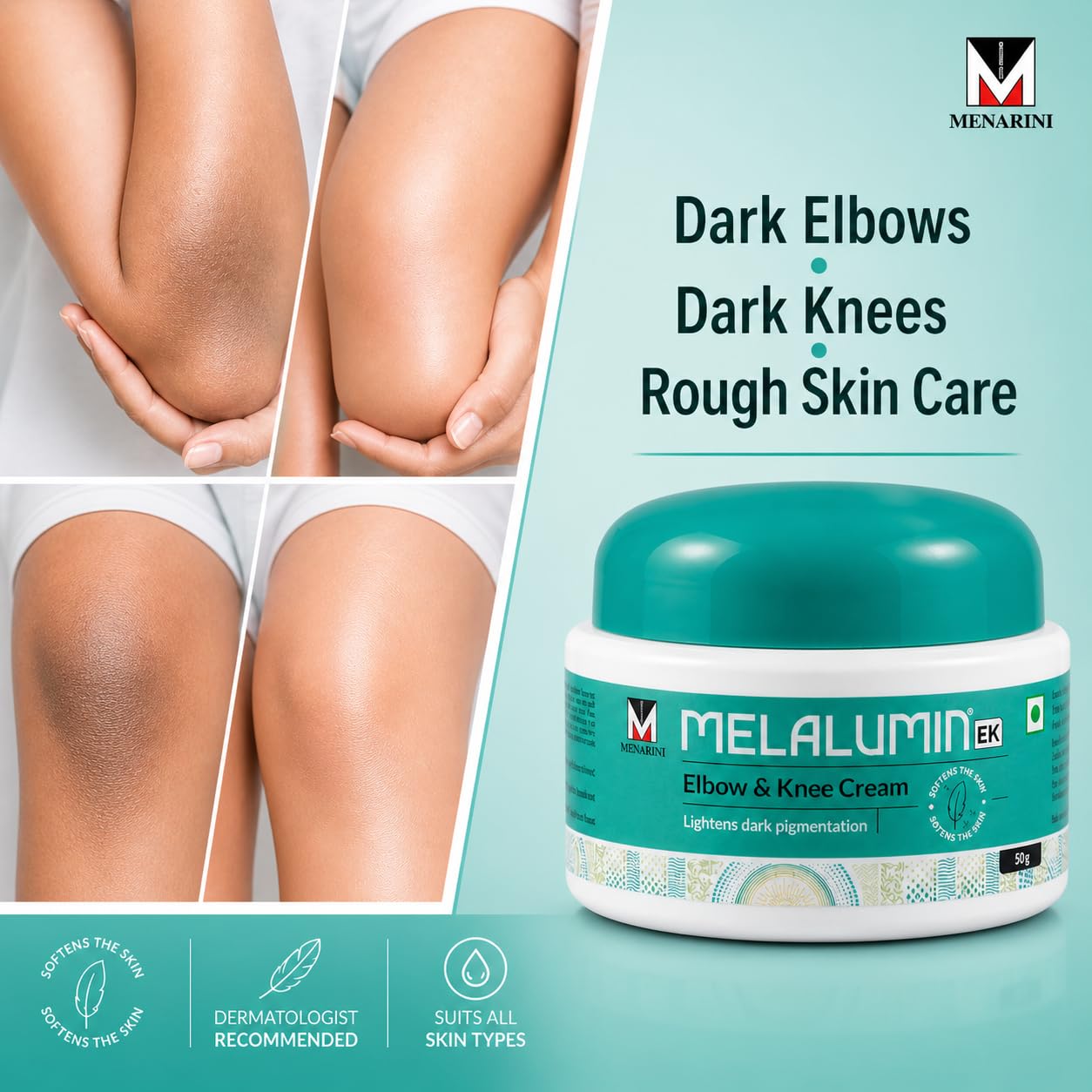 MELALUMIN EK Elbow & Knee Cream 50g | Depigmentation Skincare for Dark Elbows, Knees & Rough Skin