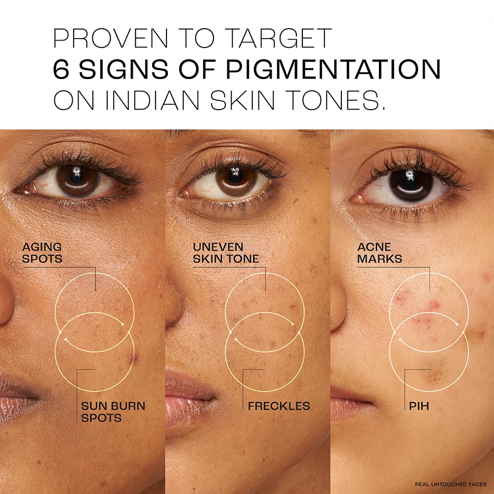 Lakme Perfect Radiance Pigmentation Treatment Day Gel Crème with 10% Niacinamide Resorcinol Complex 7 Antioxidants, 50g