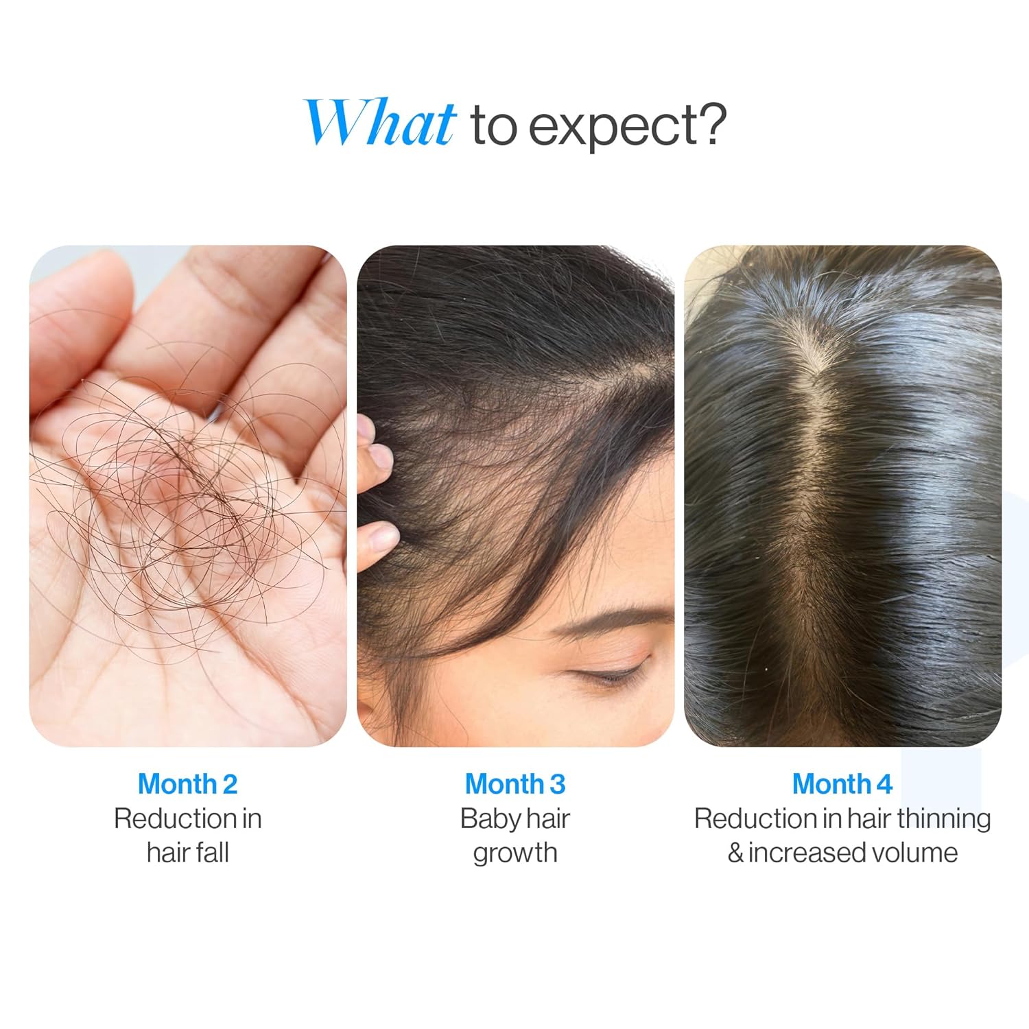 BeBodywise Rosemary Hair Growth Serum (Roll On) - 25 ml - Pack of 3