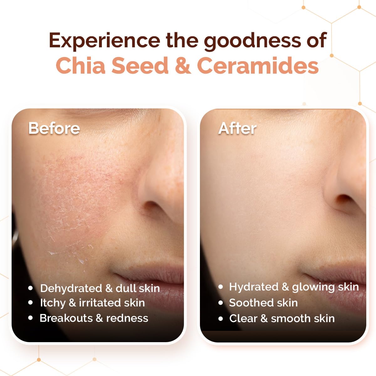Mamaearth Chia Oil-Free Moisturizer with Chia Seed & Ceramides for Healthy Skin Barrier - 80 gm