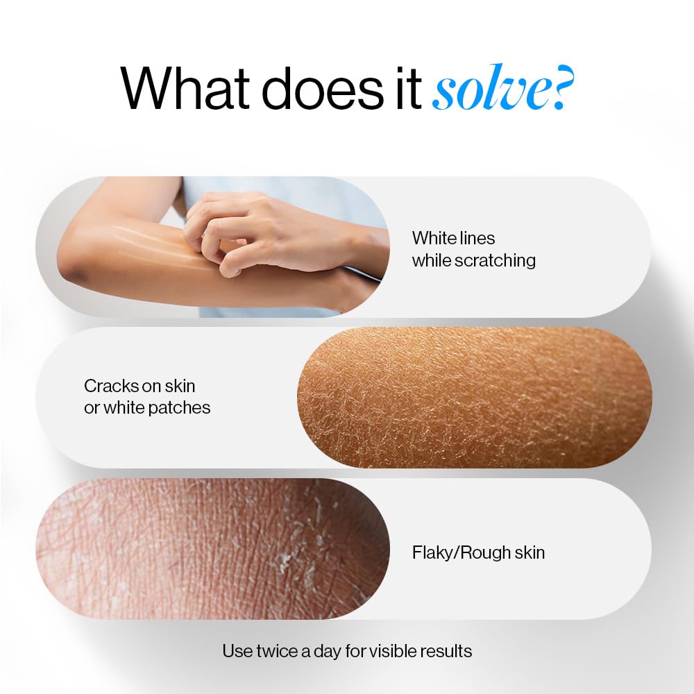 BeBodywise 10% Urea Body Lotion - 300 ml