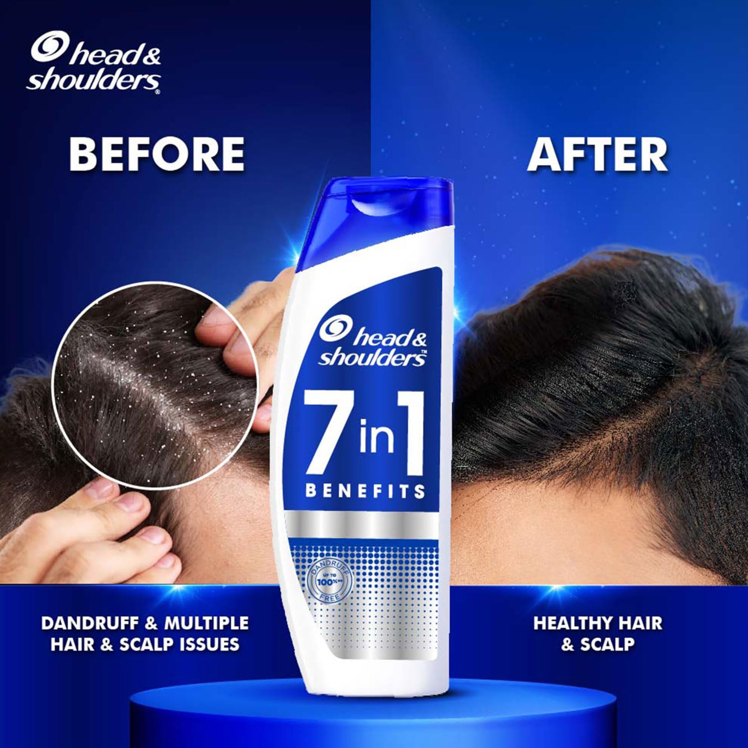 Head & Shoulders 7in1 Anti-dandruff Shampoo | 7 Benefits for Men and Women, 1000ml