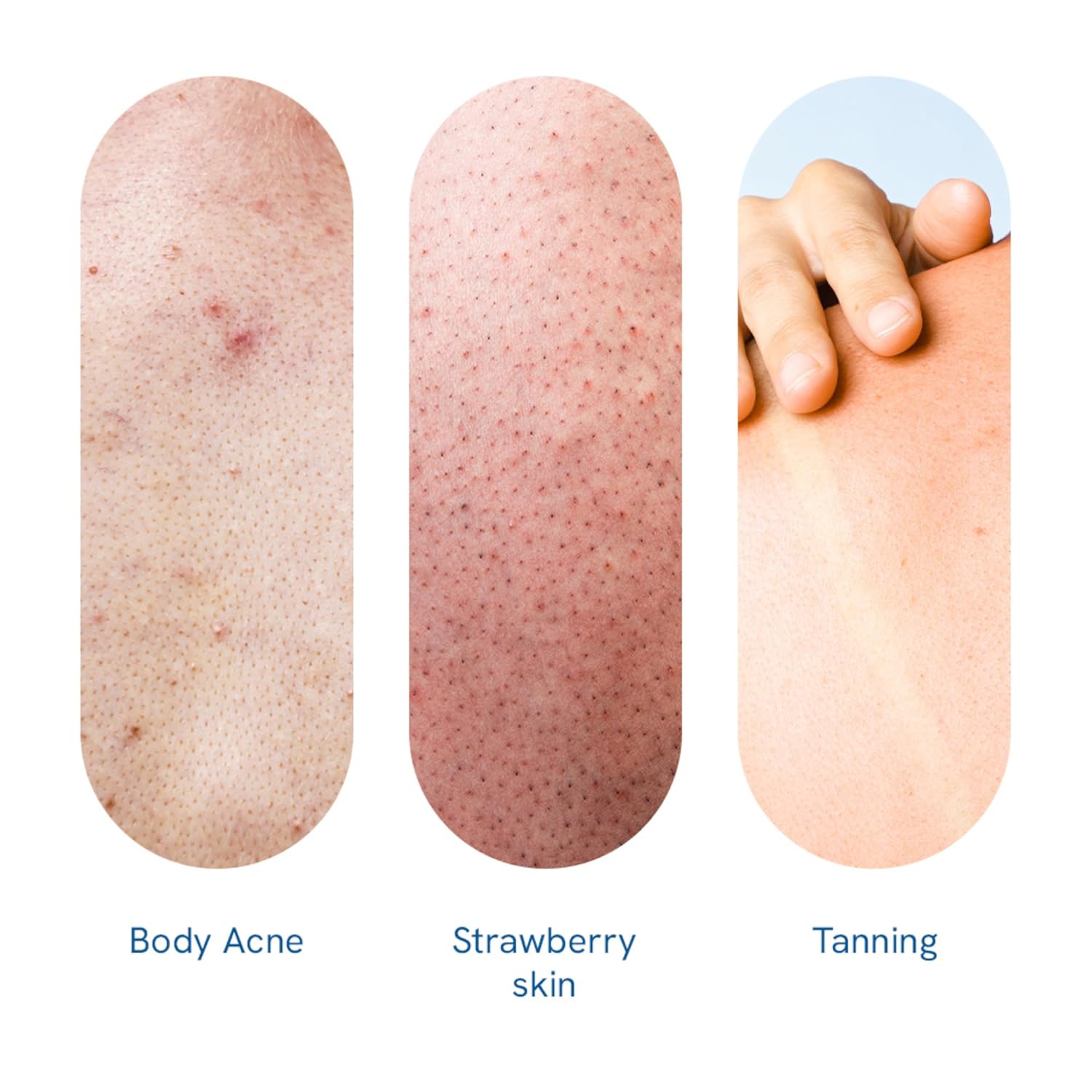 BeBodywise 10% AHA Lactic Acid Body Scrub - 200 gm