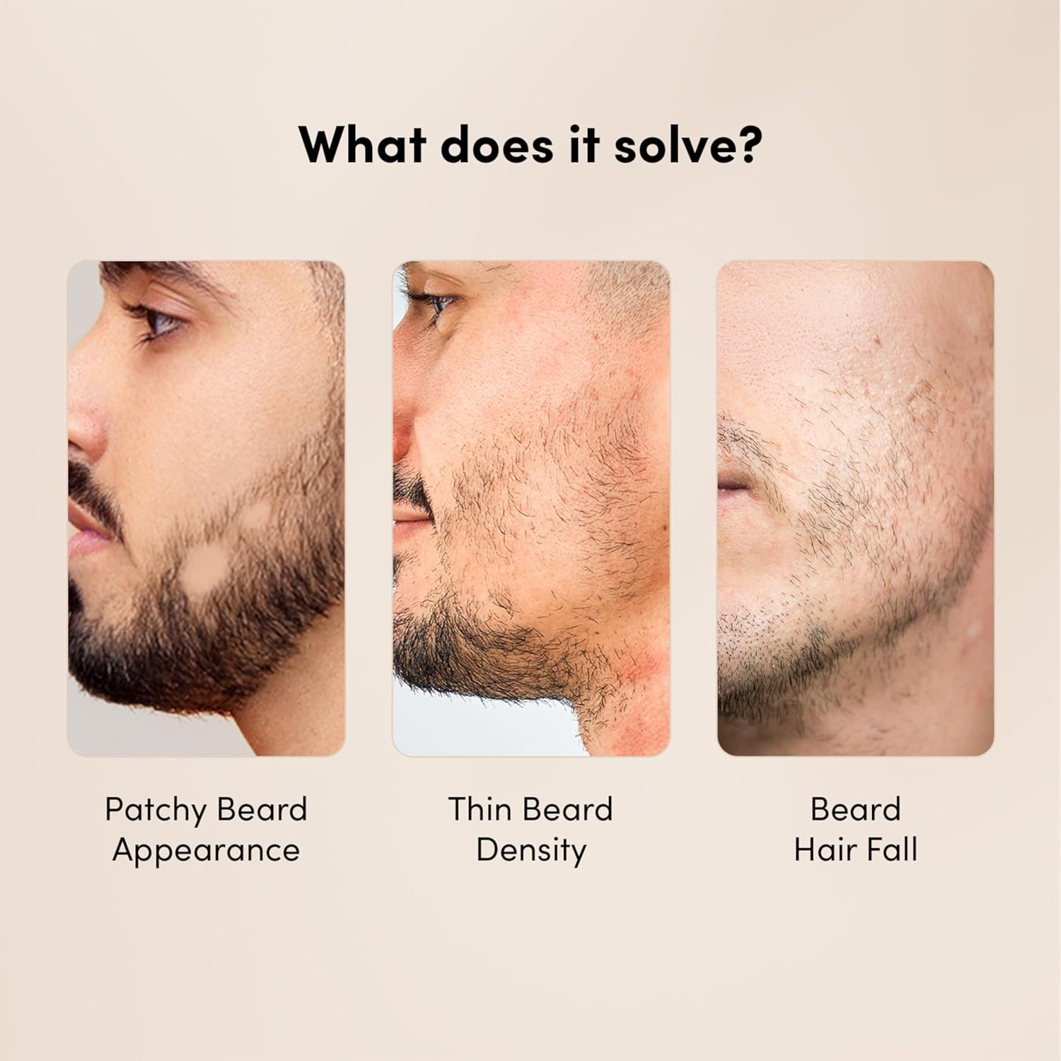 Man Matters BeardGro Beard Growth Serum for Men 30ml | 4% Anagain, 2% Aminexil, 1% Rosemary | Reduces Patchy Beard, Promotes Thicker Beard Growth | Lightweight and Fast Absorption