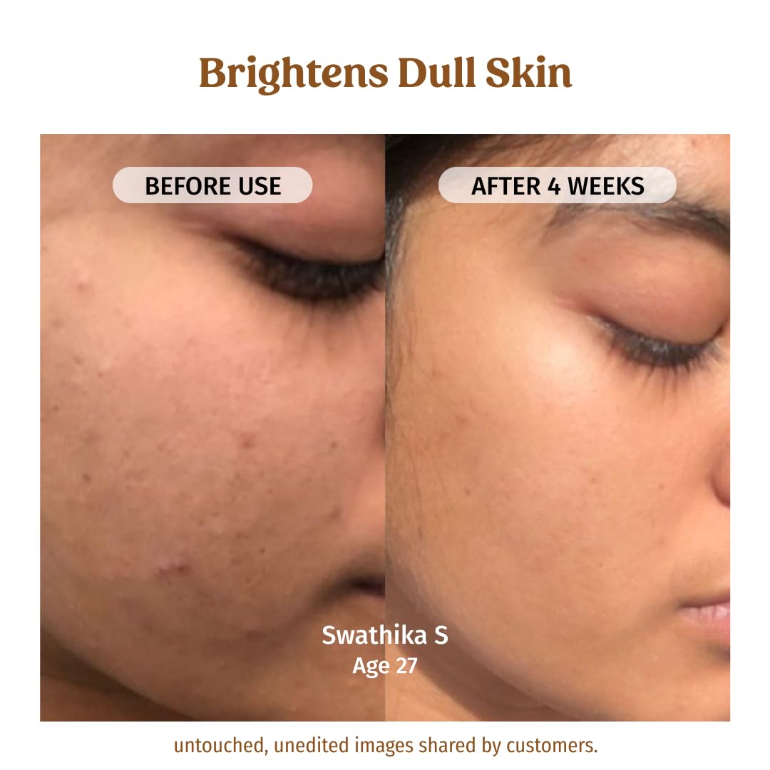 VILVAH Milk Drops Skin Brightening Serum With Rice Milk, Marine Algae Extract & Alpha-Arbutin (20ml)