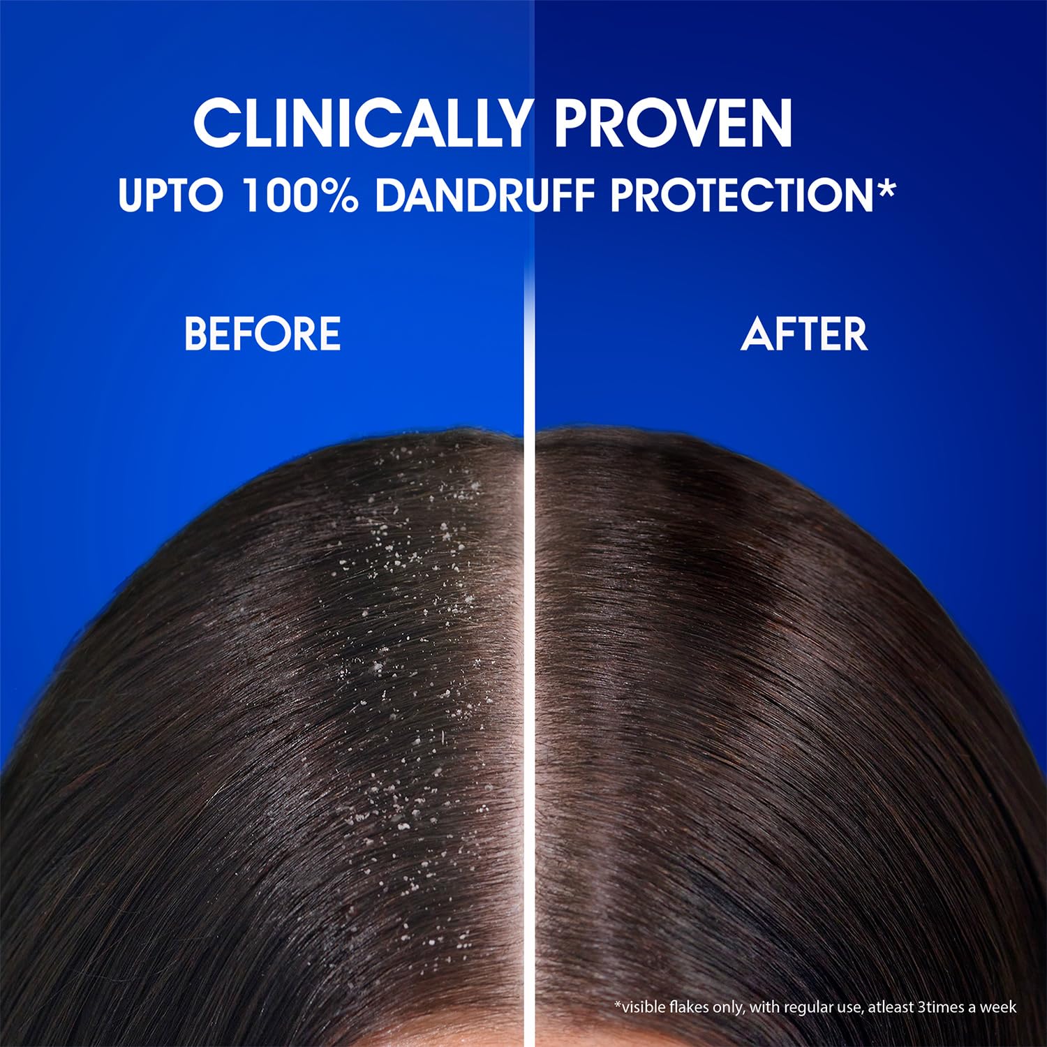 Head & Shoulders , Anti Dandruff Shampoo, Silky Black, 180 ML