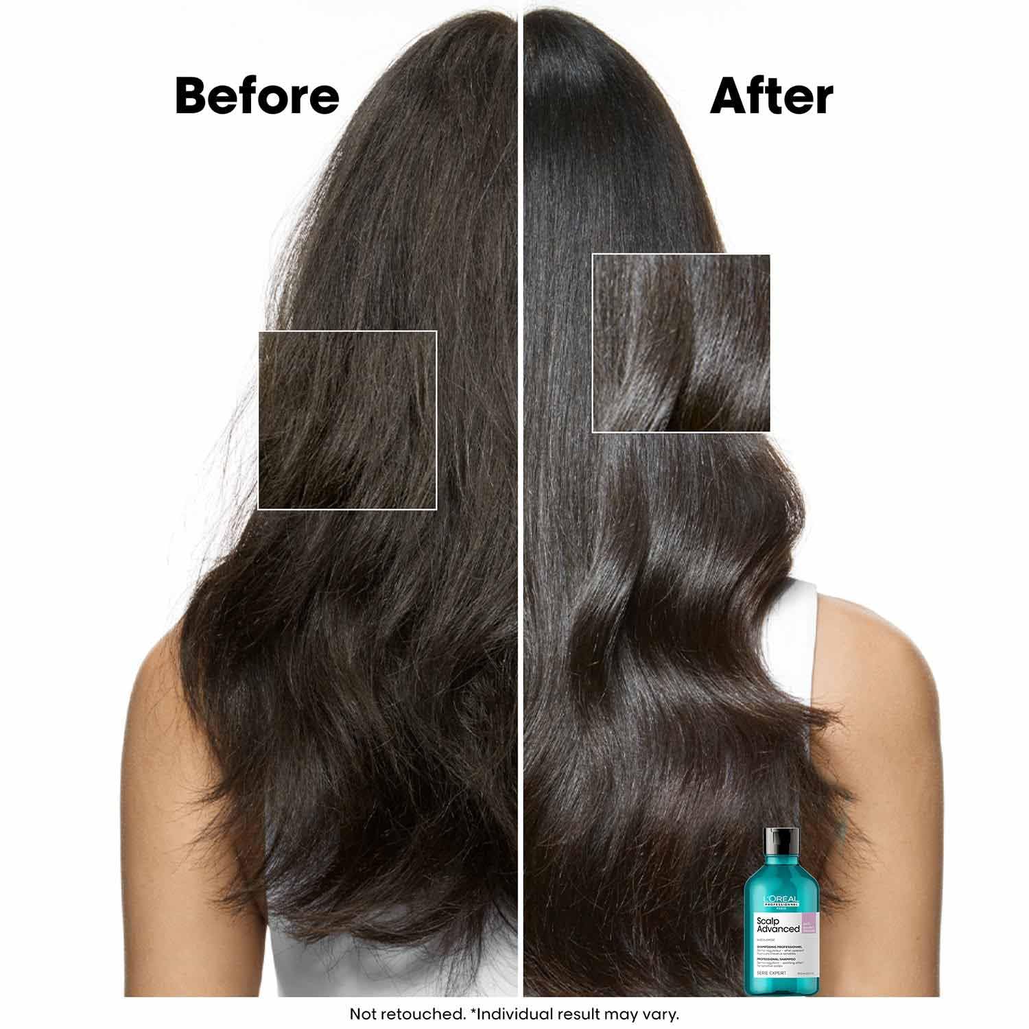 LOREAL PROFESSIONNEL PARIS Scalp Advanced Anti-Discomfort Shampoo 300ml