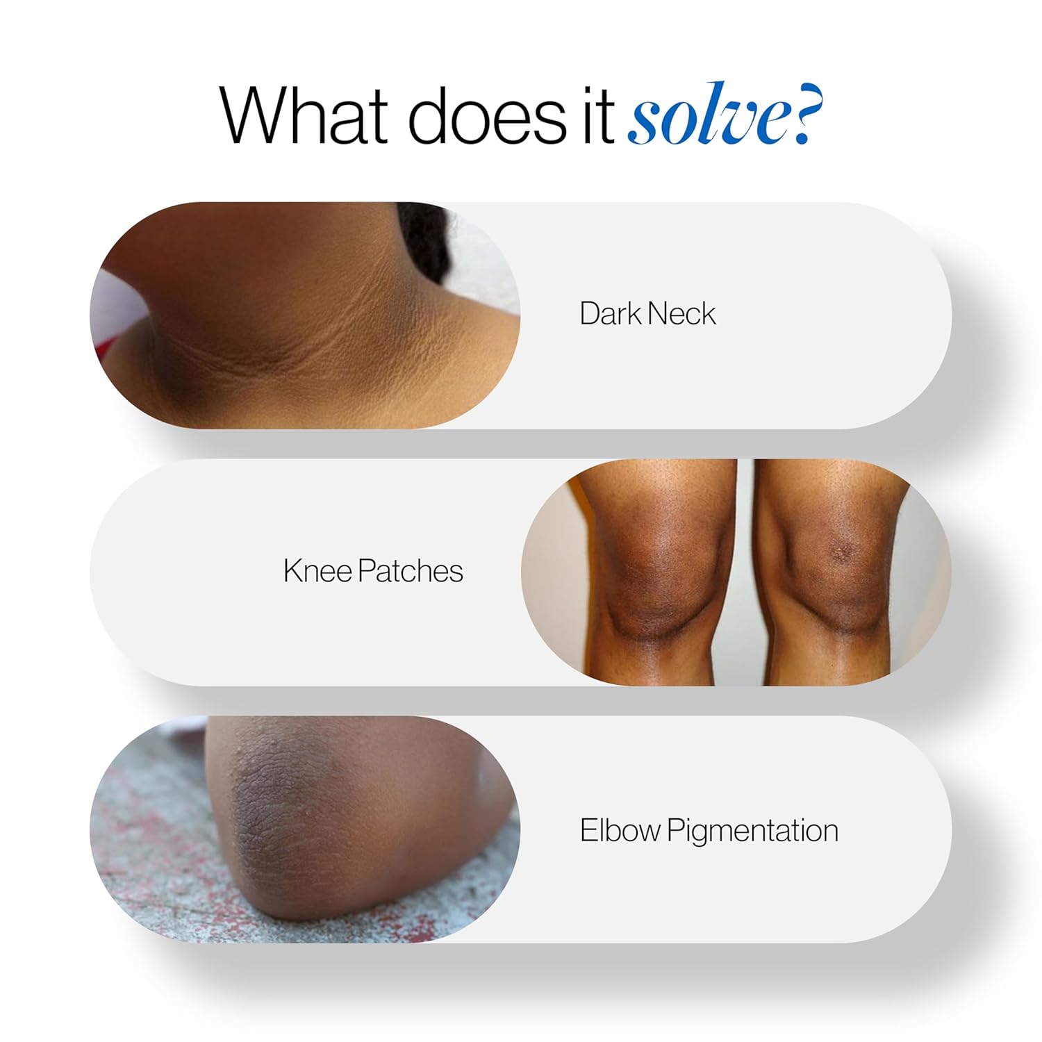 BeBodywise Pigmentation Repair Cream - 100 gm