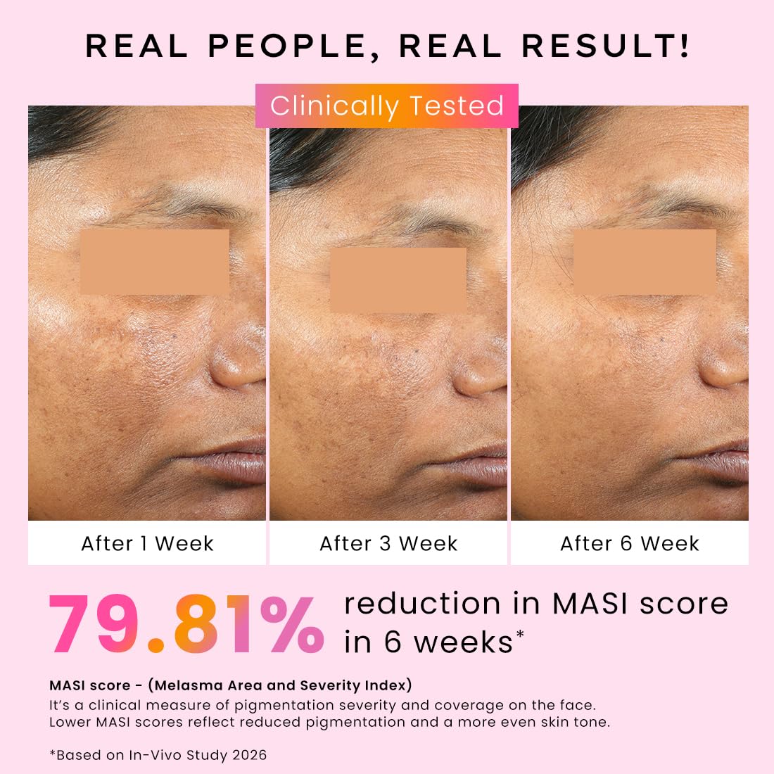 Hyphen Biphasic Advanced De-Pigmentation Serum, Correct & Prevent Pigmentation In-Vivo Tested (30ml)