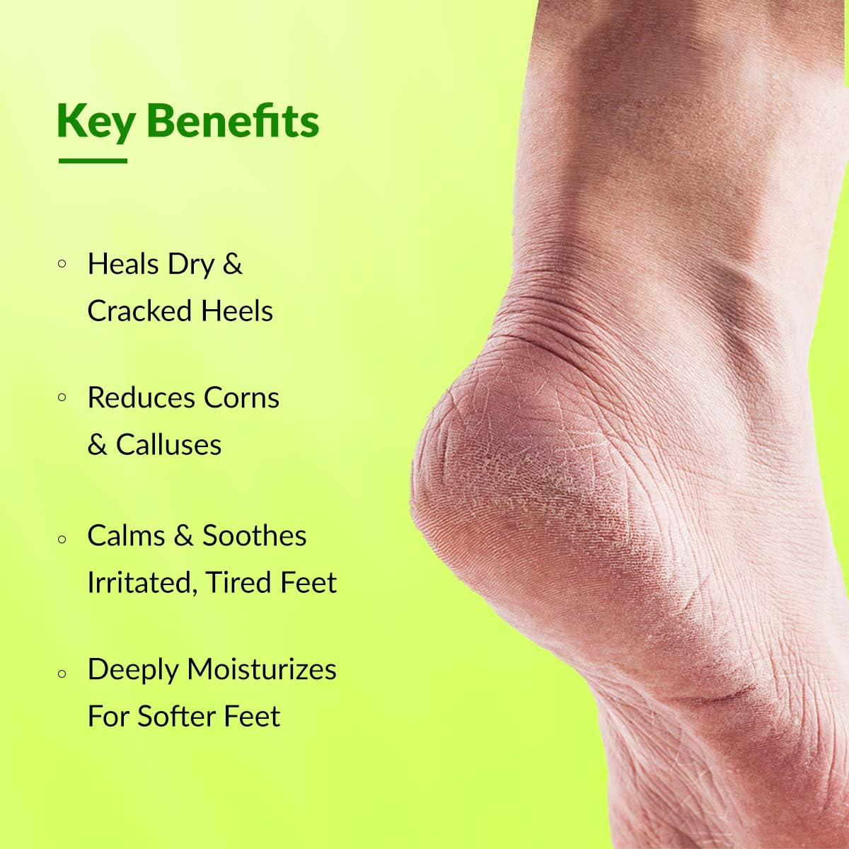 Fixderma Foobetik Cream, Foot cream, 50g For Dry & Cracked Feet, Calloused or Chapped Skin