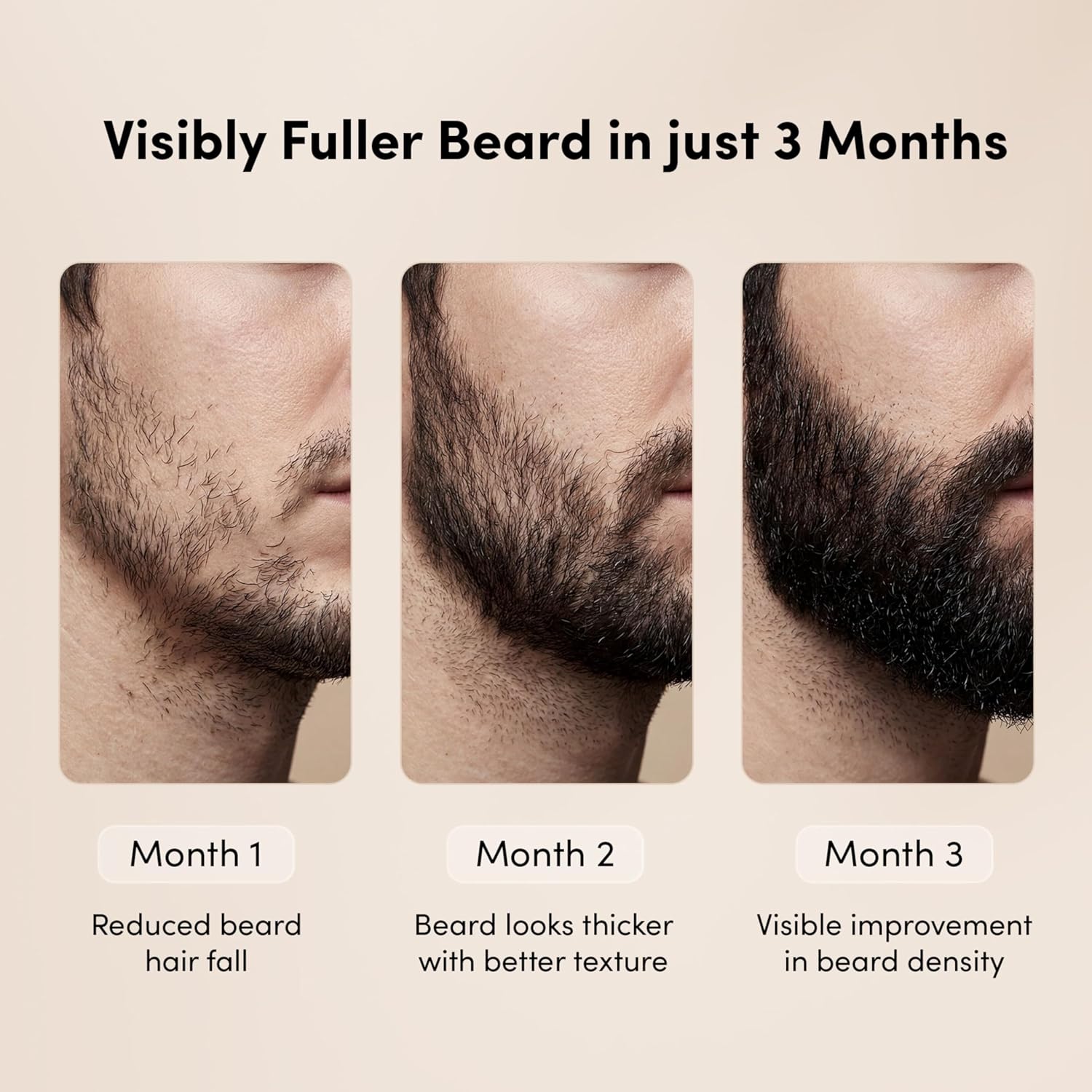 Man Matters BeardGro Beard Growth Serum for Men 30ml | 4% Anagain, 2% Aminexil, 1% Rosemary | Reduces Patchy Beard, Promotes Thicker Beard Growth | Lightweight and Fast Absorption
