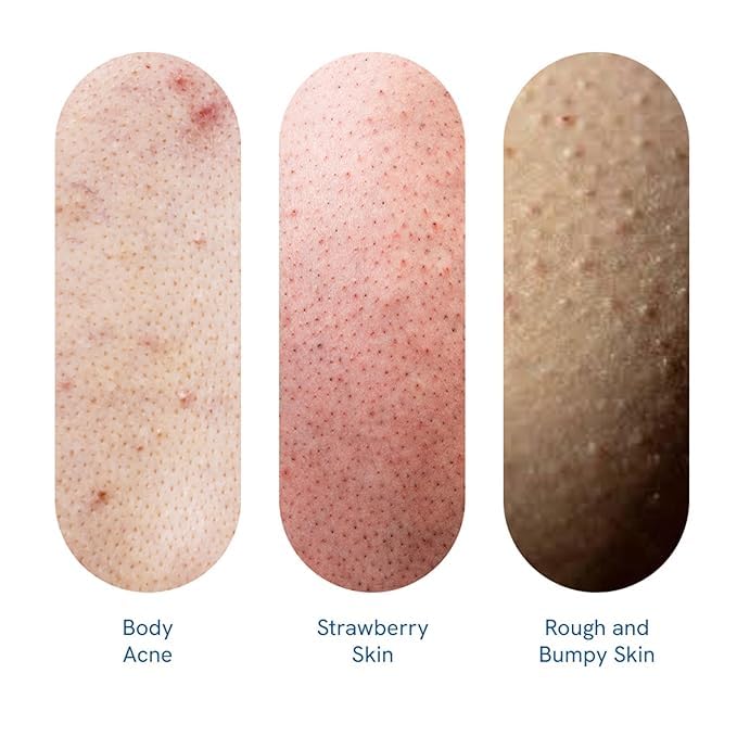 BeBodywise 1% Salicylic Acid Body Wash & 4% AHA BHA Underarm Roll On - Helps Exfoliate Skin - combo