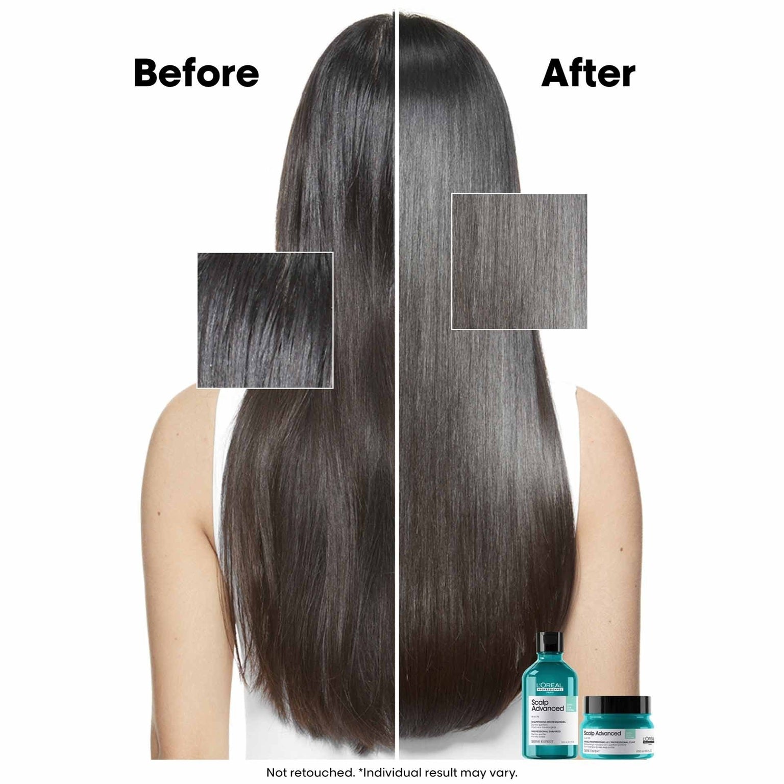 LOreal Professionnel Scalp Advanced Anti-Oiliness Dermo-Purifier Shampoo 300ml