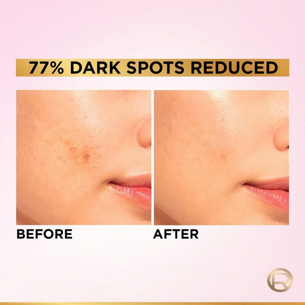 LOreal Paris Glycolic Bright 8% [Melasyl + Niacinamide] Face Serum For Brightening Dark Spots - 15 ml