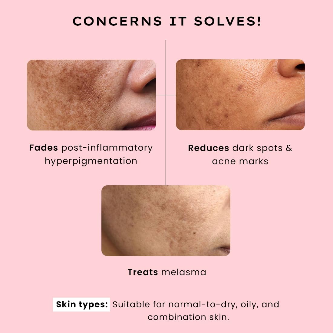 Hyphen Biphasic Advanced De-Pigmentation Serum, Correct & Prevent Pigmentation In-Vivo Tested (30ml)