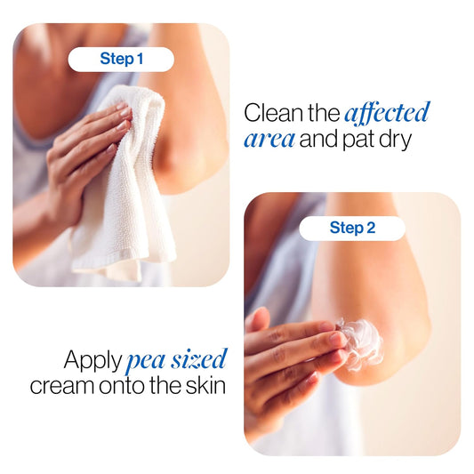 BeBodywise Pigmentation Repair Cream - 100 gm