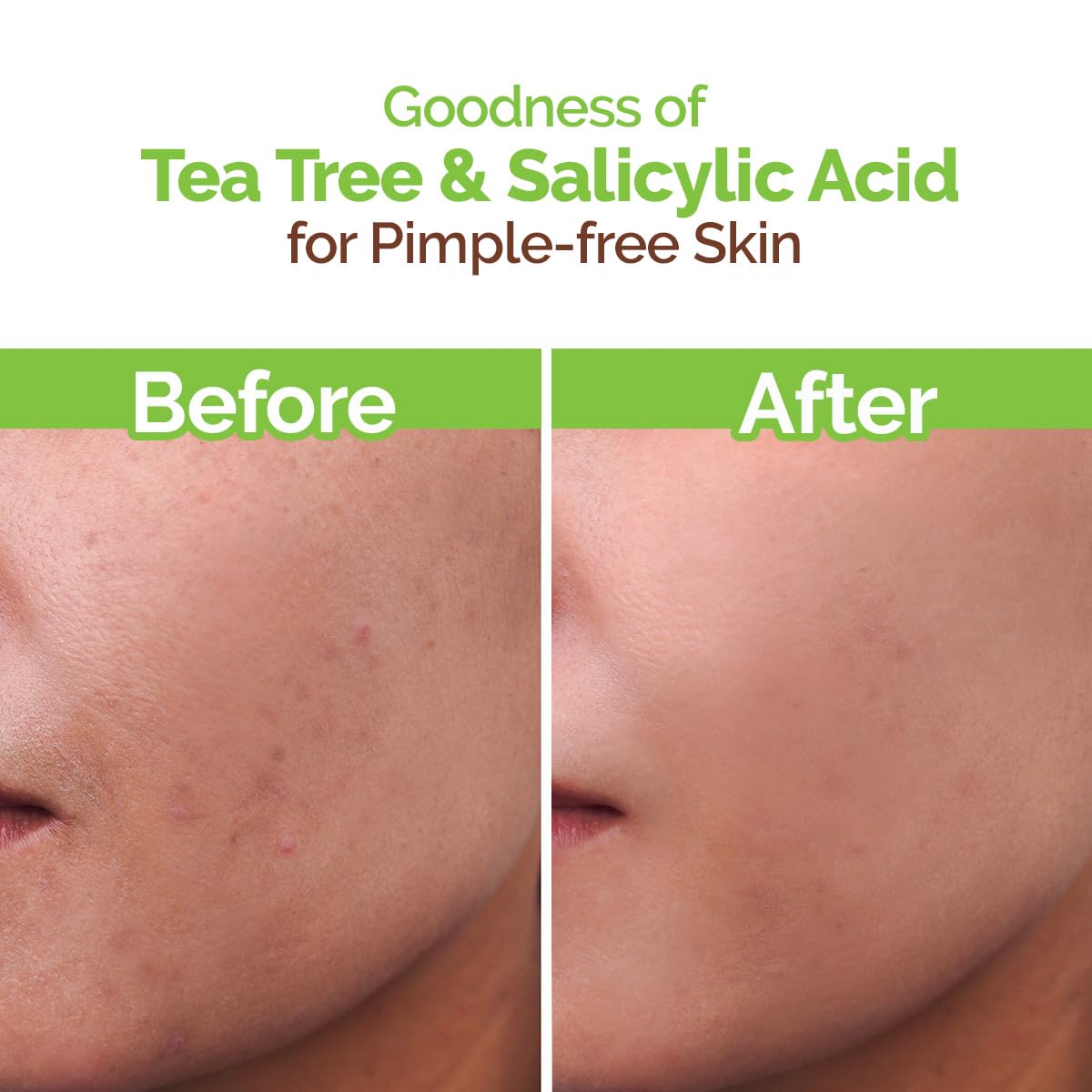 Mamaearth Tea Tree Pimple Control, Anti Acne Face Wash with Tea Tree & Salicylic for Oily & Acne-Prone Skin - 100 ml