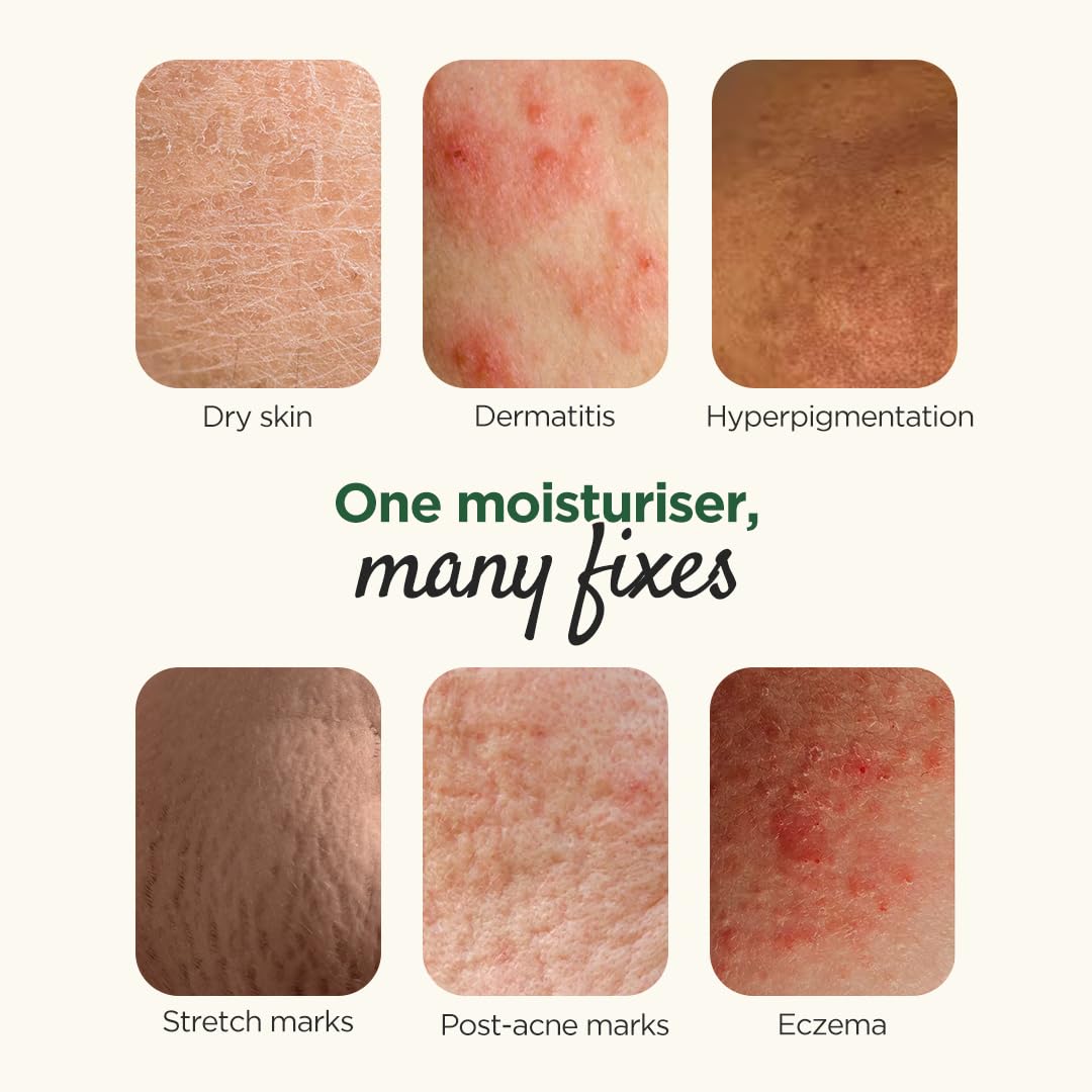 Glenmark Elovera Moisturising Cream For Dry Skin - 150 gm