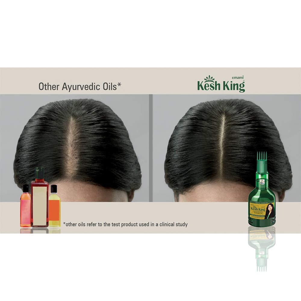 Emami Kesh King Ayurvedic Scalp And Medicine Grows New Hair Reduces Hair fall Capsule (4 Box X 30) + Hair Oil (100 ml)