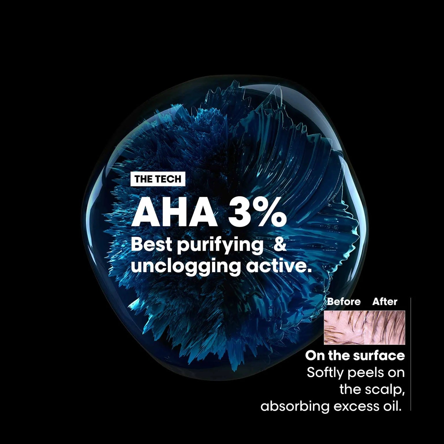 LOreal Professionnel Scalp Advanced Anti-Oiliness Dermo-Purifier Shampoo 300ml