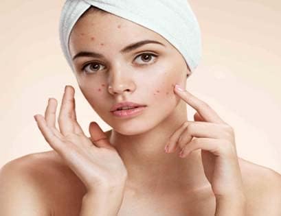 Dr Bhushan’s Acne & Pimples therapy Kit