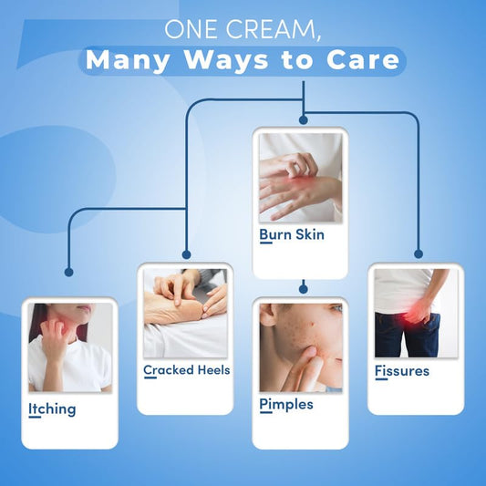 Kailas Jeevan Ayurvedic Cream for Pimples - Natural Acne Relief and Clear Skin Formula 120G