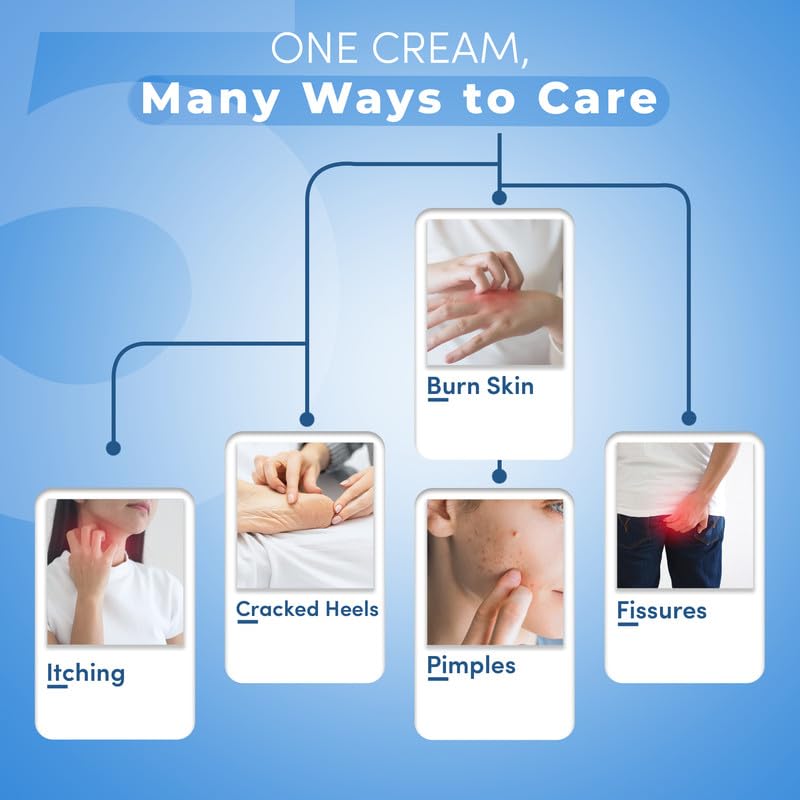 Kailas Jeevan Ayurvedic Cream for Pimples - Natural Acne Relief and Clear Skin Formula 120G