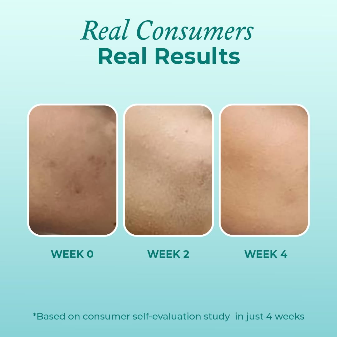 The Pink Foundry Super Clarifying Face Serum With 12% Niacinamide - 15ml