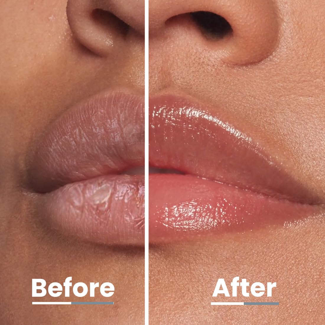 Hyphen Vitamin Infused Peptide Lip Balm - Vanilla For Dry & Chapped Lips, Hydrates & Moisturizes (10 g)