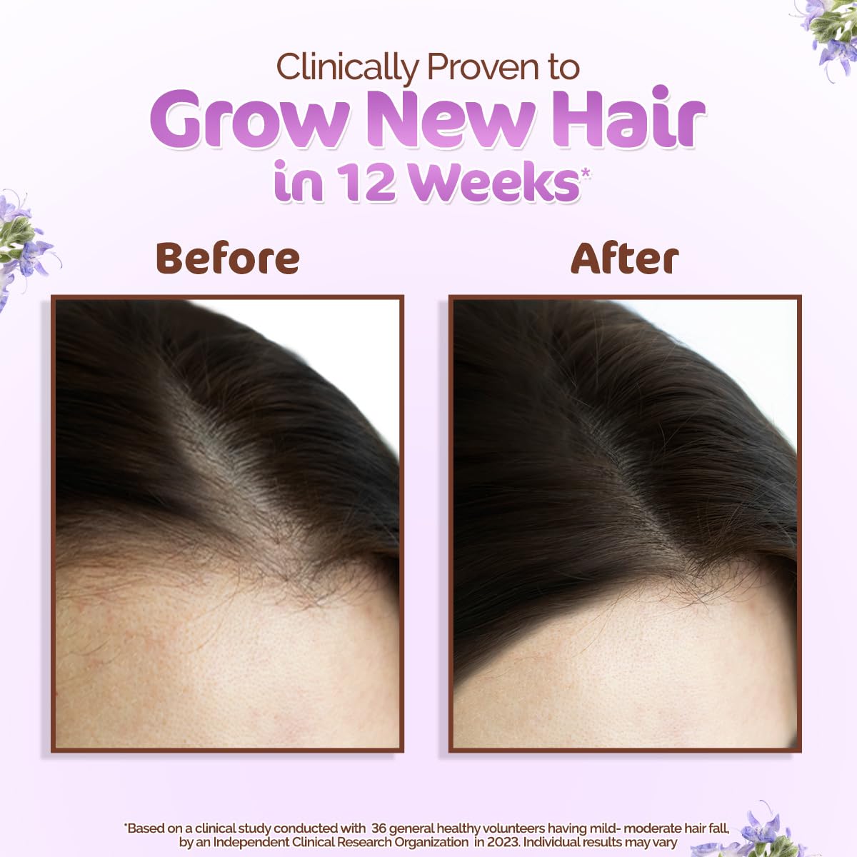 Mamaearth Rosemary Hair Growth Oil with Rosemary & Methi Dana - 150 ml