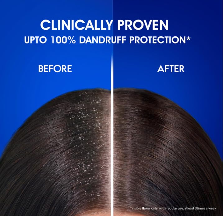 Head & Shoulders Anti-Dandruff Shampoo, Smooth & Silky, Nourishes Dry Hair, 100% Dandruff Protection, 1.2L