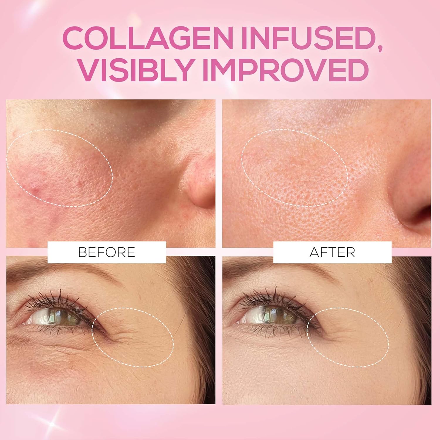 RENEE Pink Therapy Hydrolyzed Collagen Overnight Sleep Jelly Mask | Hydrates, Repairs, Smoothens & Plumps Skin | Peptides, Niacinamide & Hydrolyzed Collagen Enriched | 50 gm