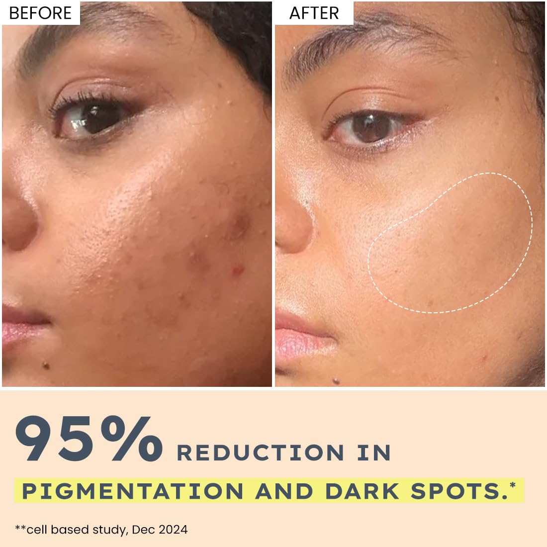 Hyphen 44% Rice Water Brightening Serum Pads (50pcs)
