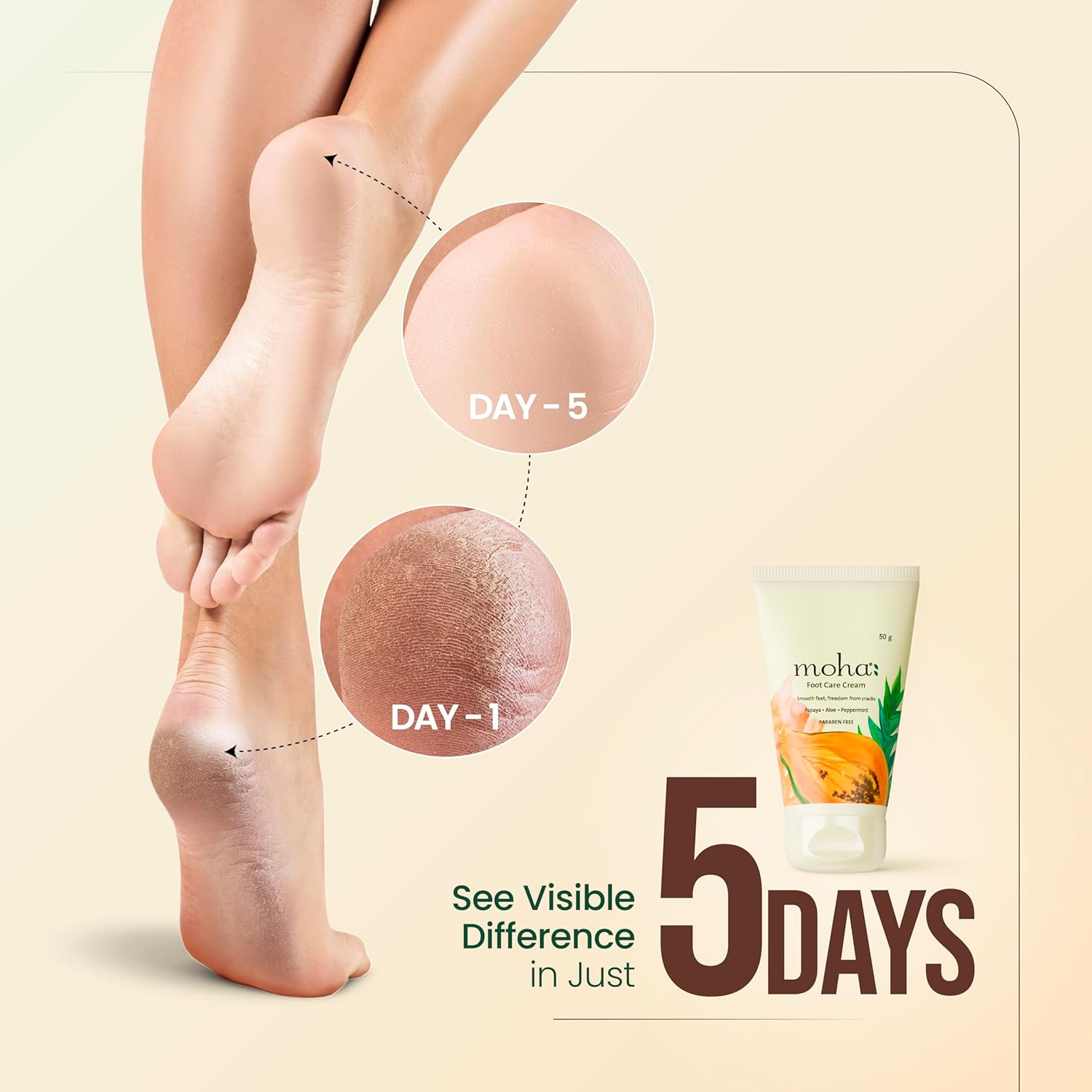 Moha Foot Cream for Dry & Cracked Feet | Deep Nourishment & Fast Healing Heel Repair Cream  | Softening, Exfoliating & Paraben-Free Foot Care for Men & Women - 50g (Pack of 1)