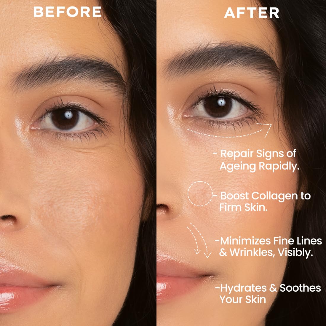 Hyphen 0.1% Retinal Reset, Retinol Derivative Serum Pro For Anti Aging, Reduce Fine Lines & Wrinkles (30ml)