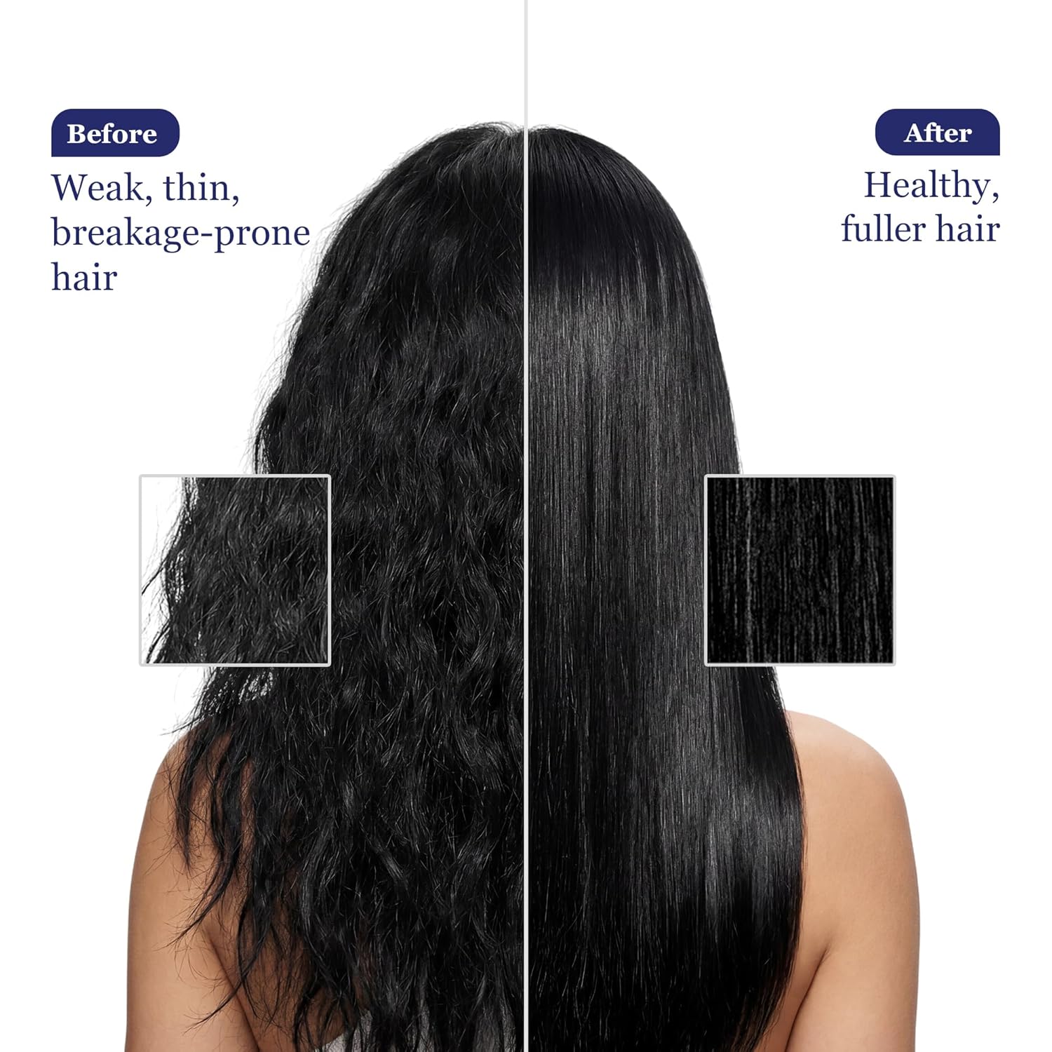 Parachute Advansed Gold Biotin & Coconut Hair Oil | Deep Nourishment for Fuller Hair| No Paraben or Silicone | 300ml