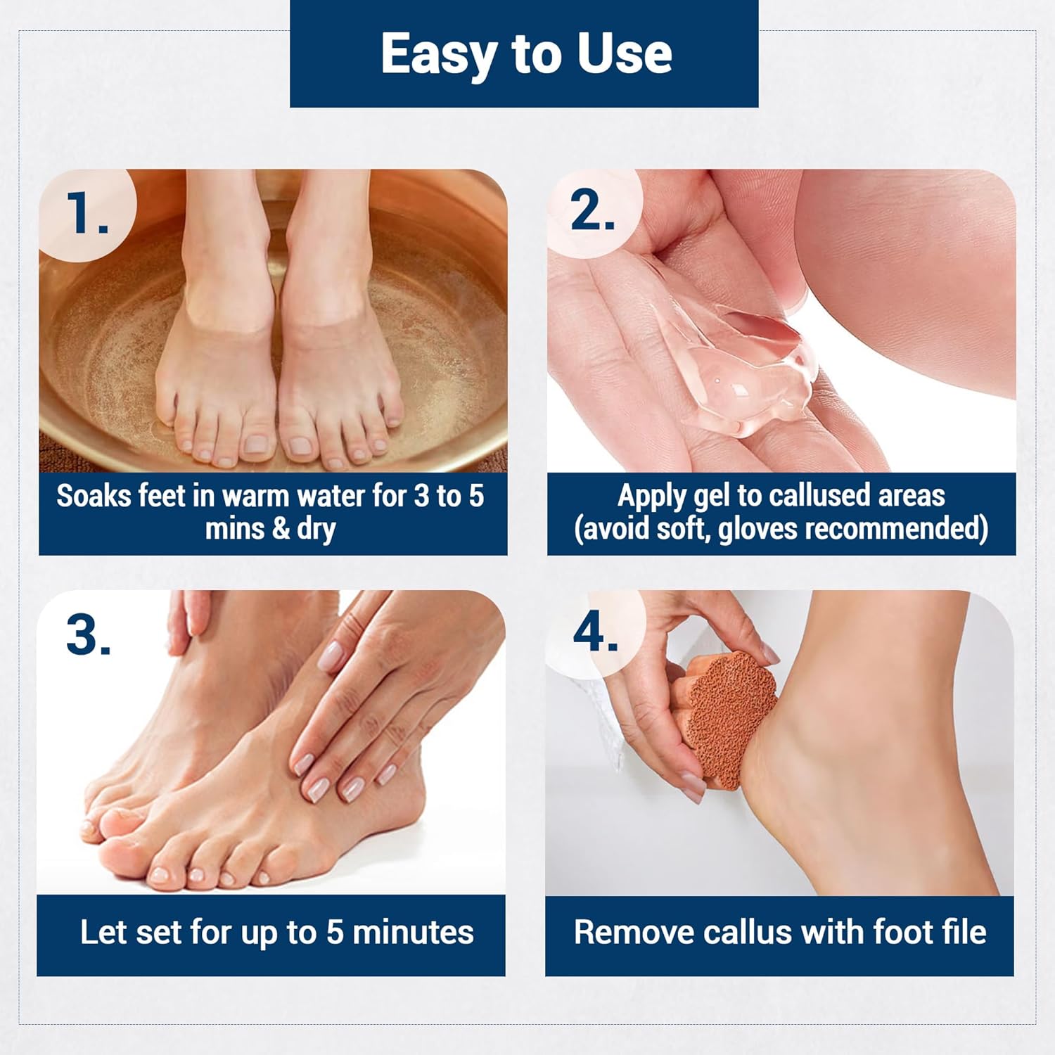 Dr Foot | Callus Remover for Feet | Callus Remover Gel | Feet Dead Skin Remover | Foot Cream for Cracked Heels | Foot Cleaner for Dead Skin | With Urea, Coconut Oil & Aloe Vera | For Men & Women