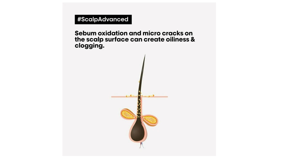 LOreal Paris Professionnel Scalp Advanced Anti-Oiliness Dermo-Purifier Shampoo Absolut Repair Professional Hair Mask - Combo 300ml + 250ml