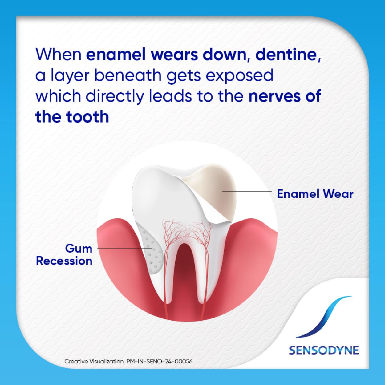 Sensodyne Toothpaste Repair and Protect | Tooth Paste for Daily Sensitivity Protection, Long-lasting Relief | Pack of 1 - 100gm | Fresh Taste | Dentist Recommended